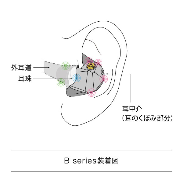 B1 [FI-B1BDSSD]